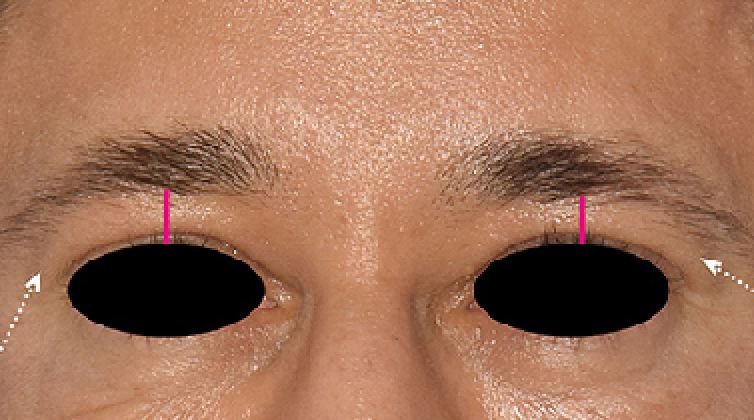 face